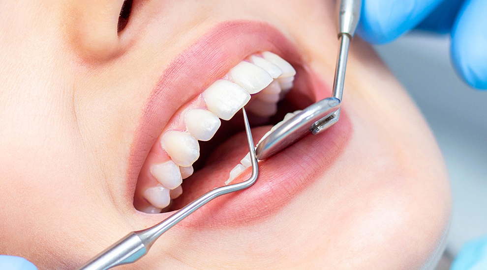 Dental Instruments